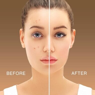 “7 Summer Skincare Essentials for Indian Skin in 2025 — Stay Glowing, Not Glazed”