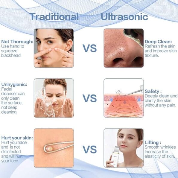White Sugar Beauty Ultrasonic Shovel Machine for Facial Skin Scrubber