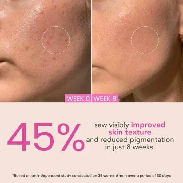 O3+ Night Repair Cream for Smoother & Radiant Skin -50g
